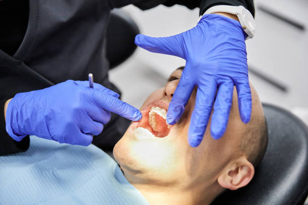 Best Emergency Wisdom Teeth Removal in Isle Of Hope, GA